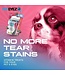 Pet Eyez Tear & Eye Support Vitamin Treats for Dogs