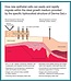 Vetoquinol Derma gel (onguent)