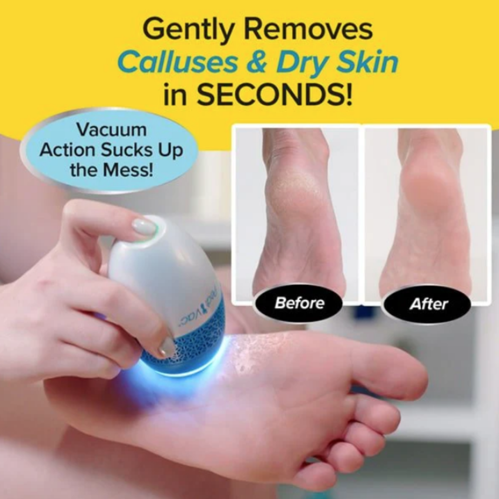 As Seen On TV Pedi Vac Callus Remover