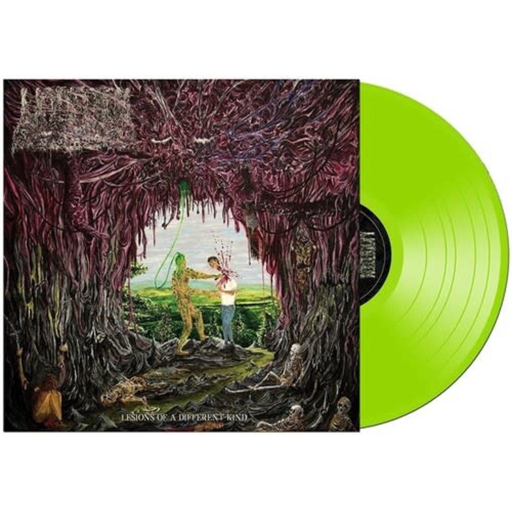 Undeath - Lesions of a Different Kind (LP) [Slime Green]