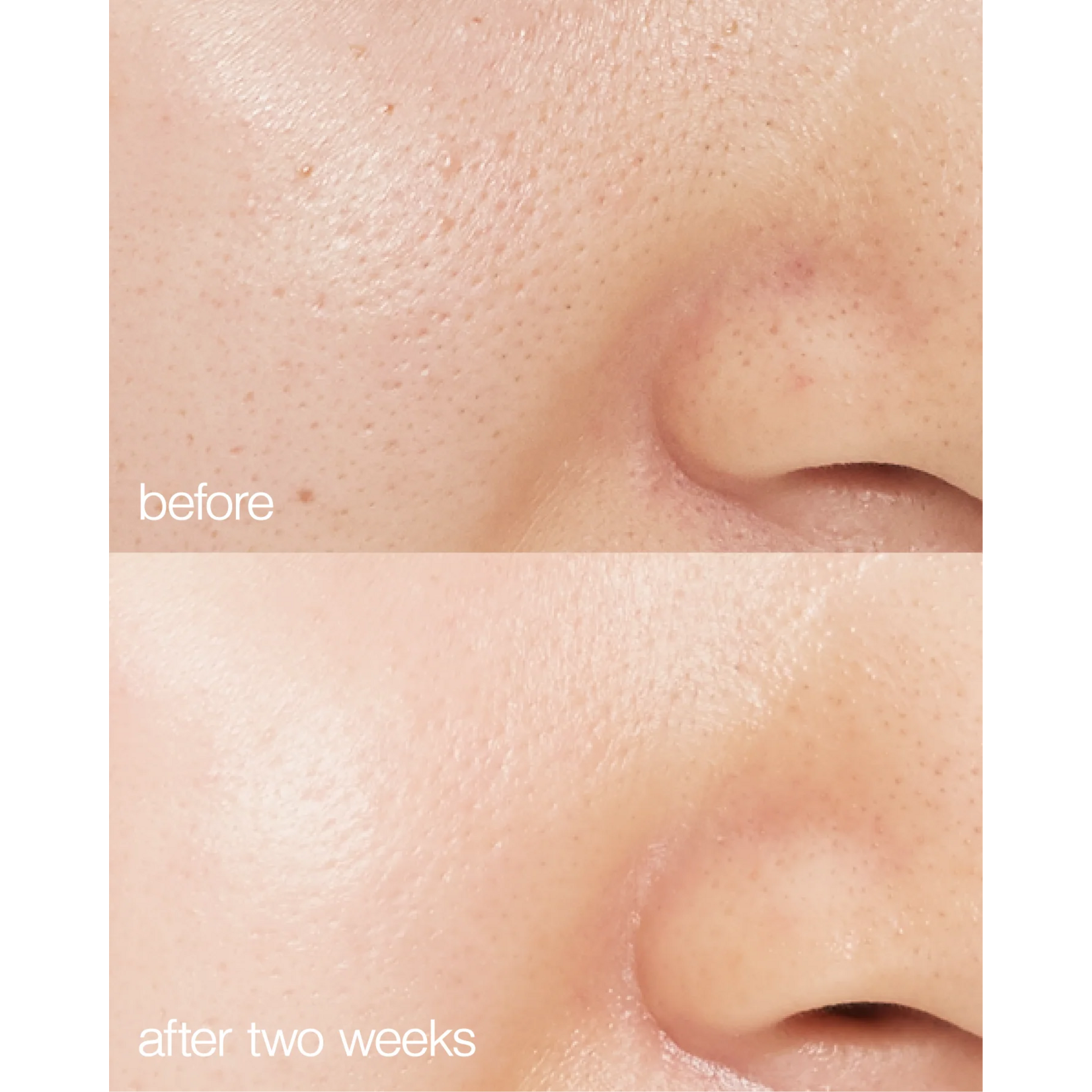 Lapcos Biome Boost Cream