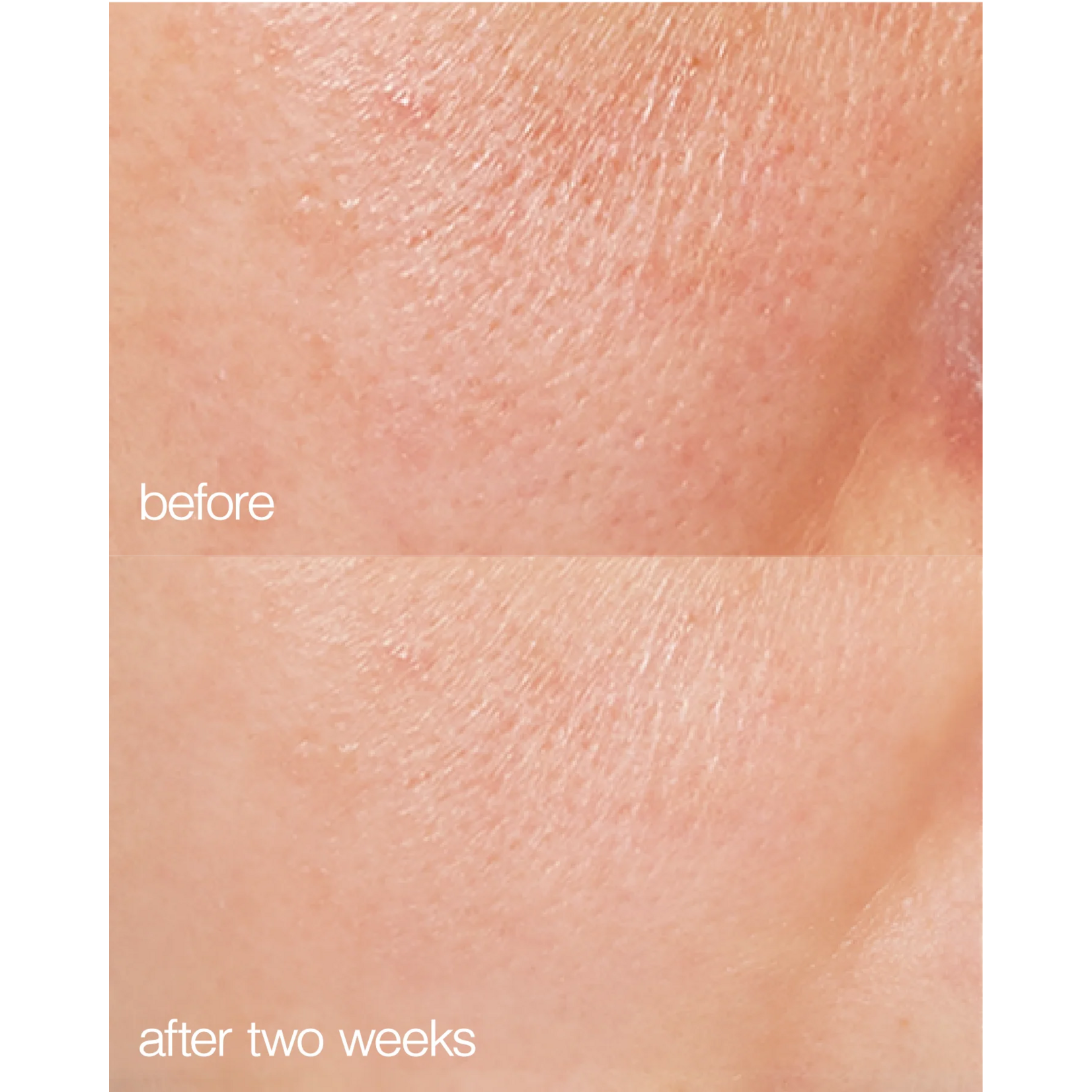 Lapcos Biome Boost Cream