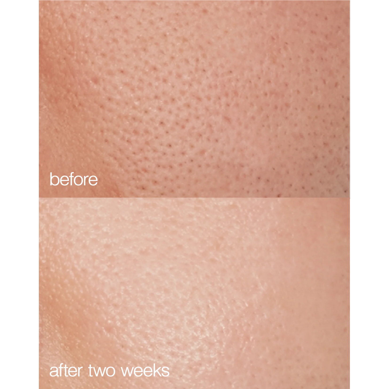 Lapcos Biome Boost Cream