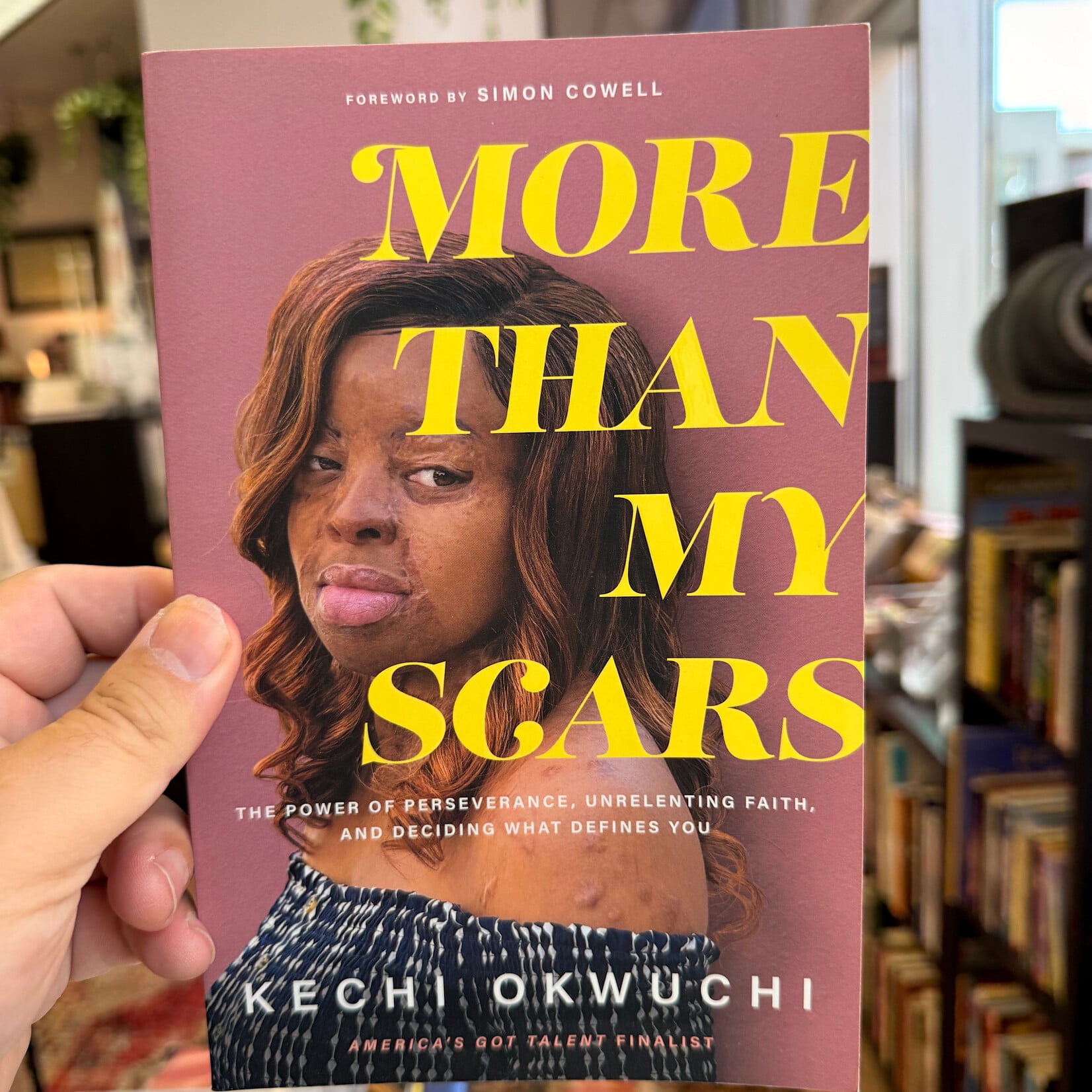 Kechi Okwuchi - More Than My Scars - Paperback (USED)