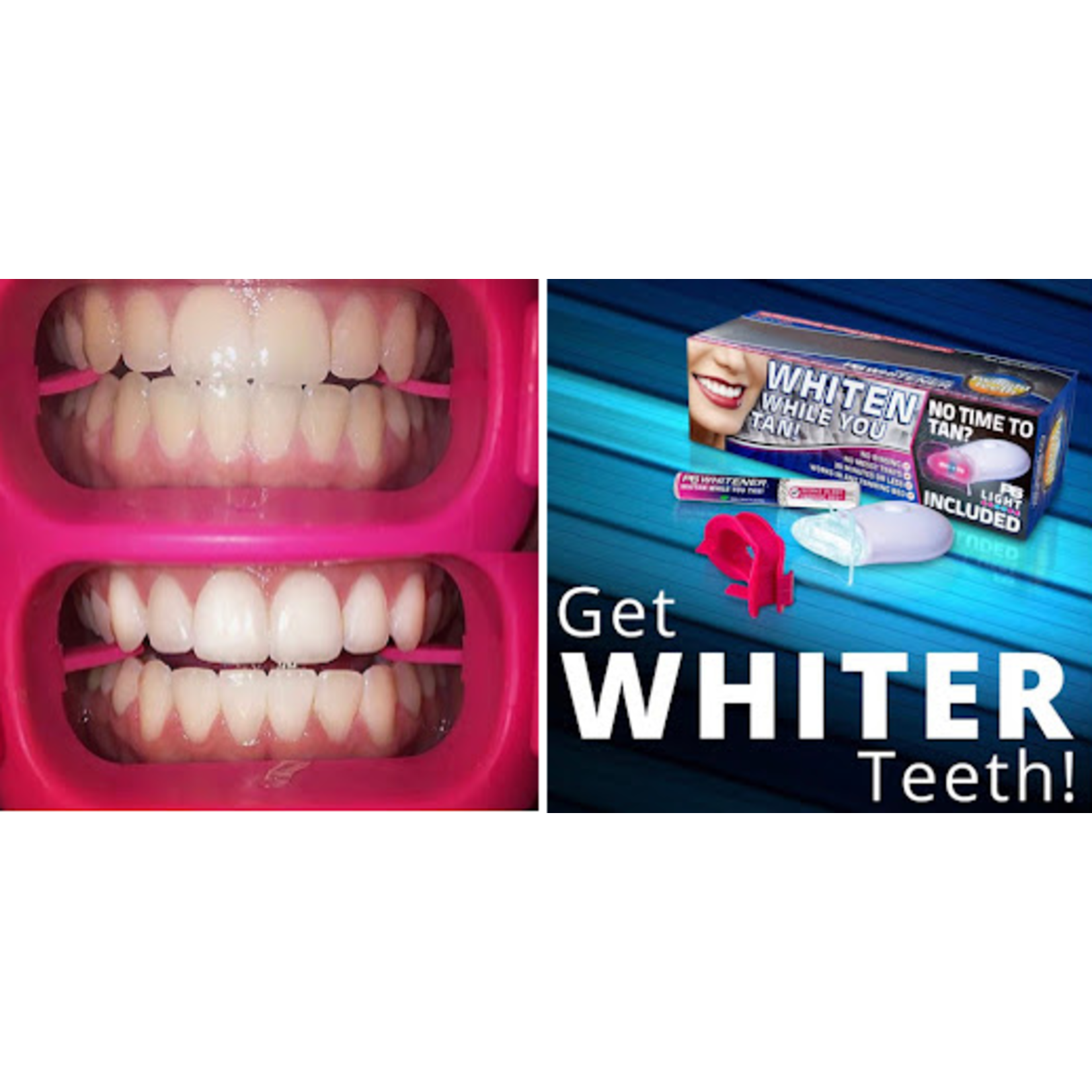 TWILIGHT TEETH Twilight Teeth Whitening Kit | Specially Designed Kit Includes Whitener Gel, Mouthpiece For Tanning Bed Use & A Powerful UV Light Mouthpiece For At Home Whitening | No Rinse Gel Whitener Formula