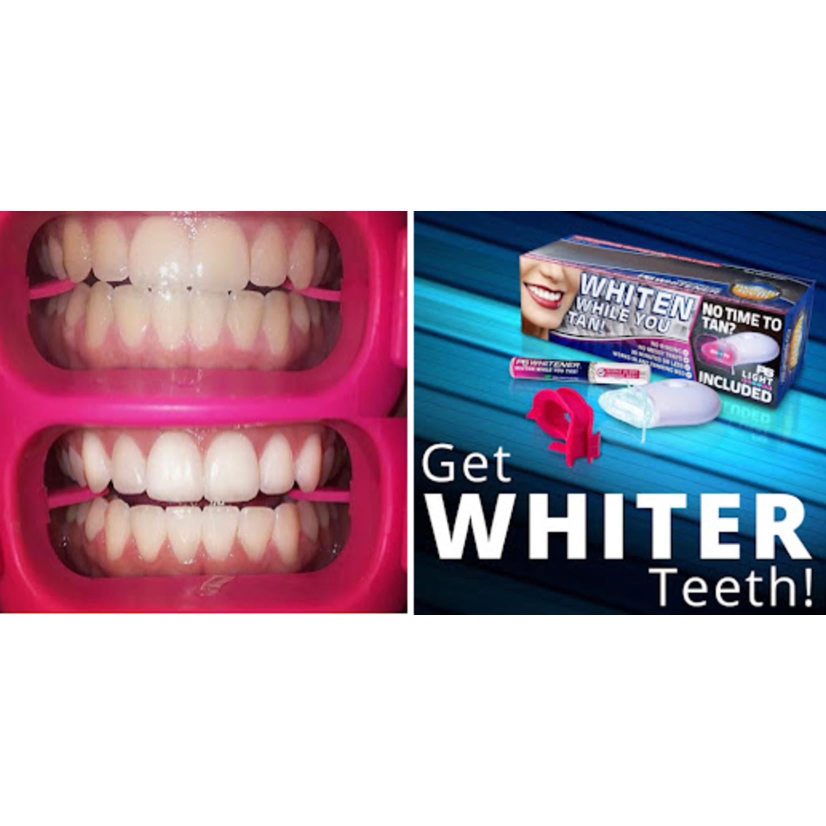 Twilight Teeth Whitening Kit | Specially Designed Kit Includes Whitener Gel, Mouthpiece For Tanning Bed Use & A Powerful UV Light Mouthpiece For At Home Whitening | No Rinse Gel Whitener Formula