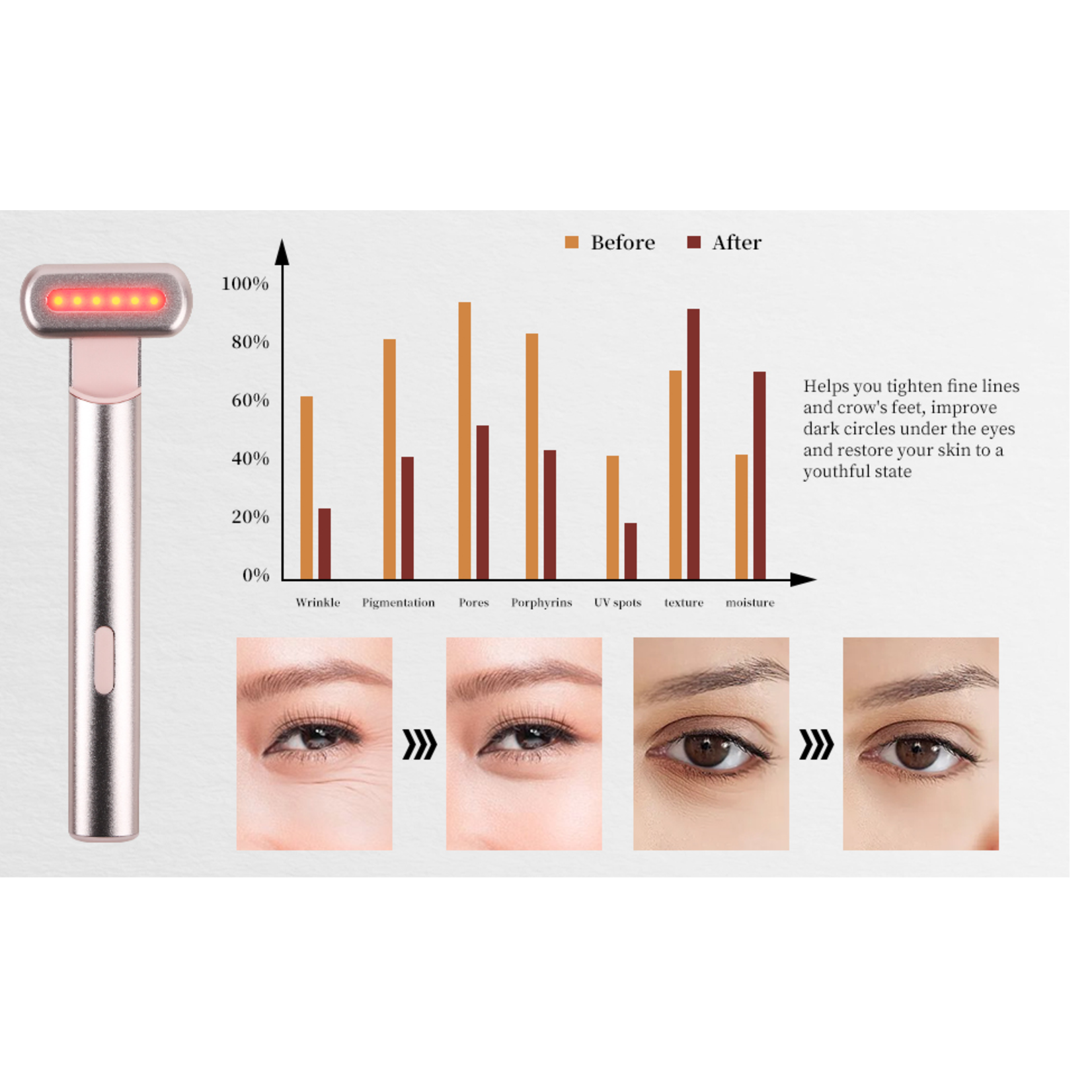 lurella Lurella Red Light Facial Wand