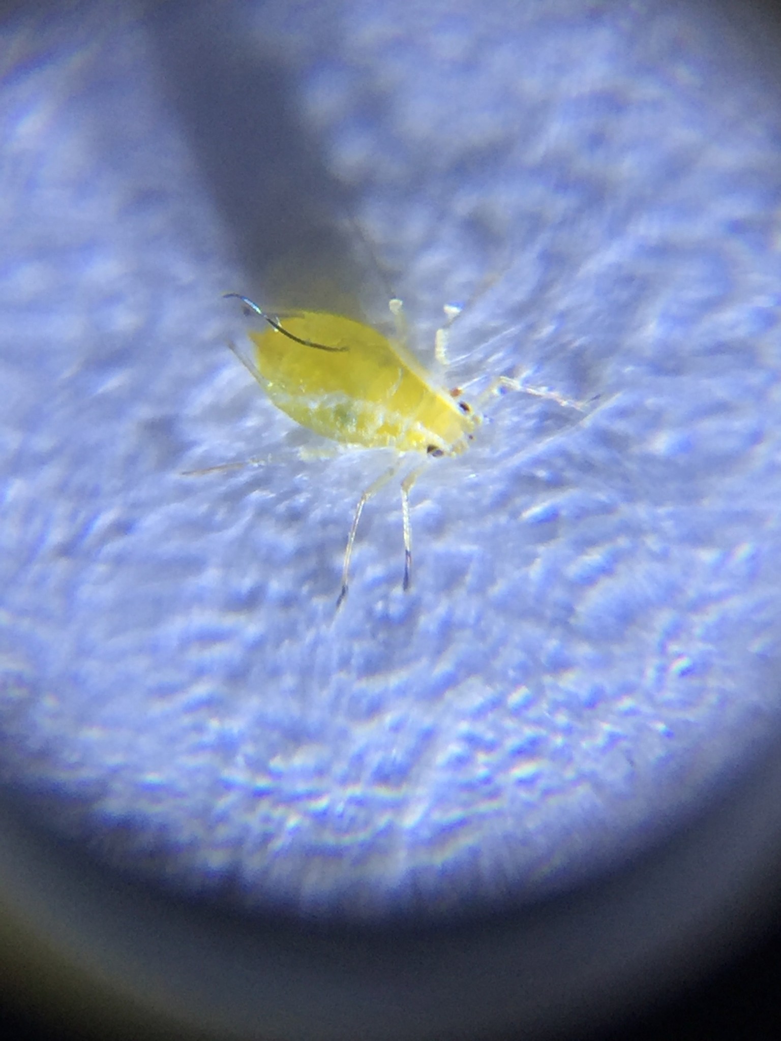 Active Eye Microscope Phone