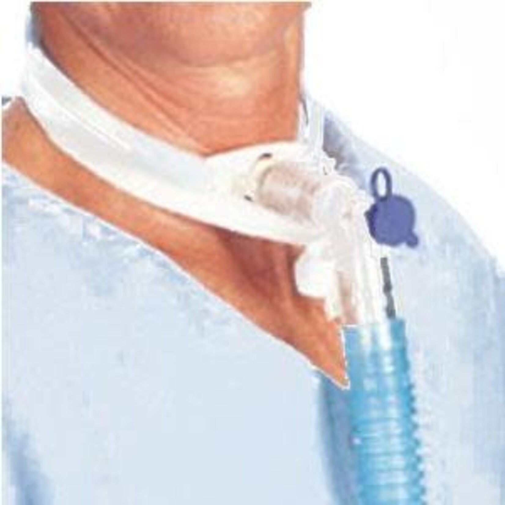Posey Trach Tube Secure Tie - Medium