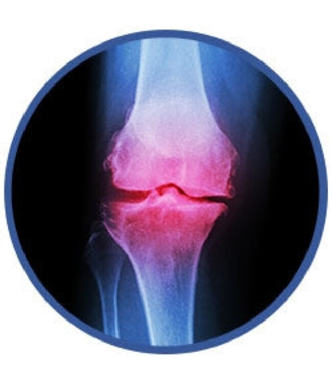 Giant Microbes Arthritis Educational Plush: Explore Joint Health!