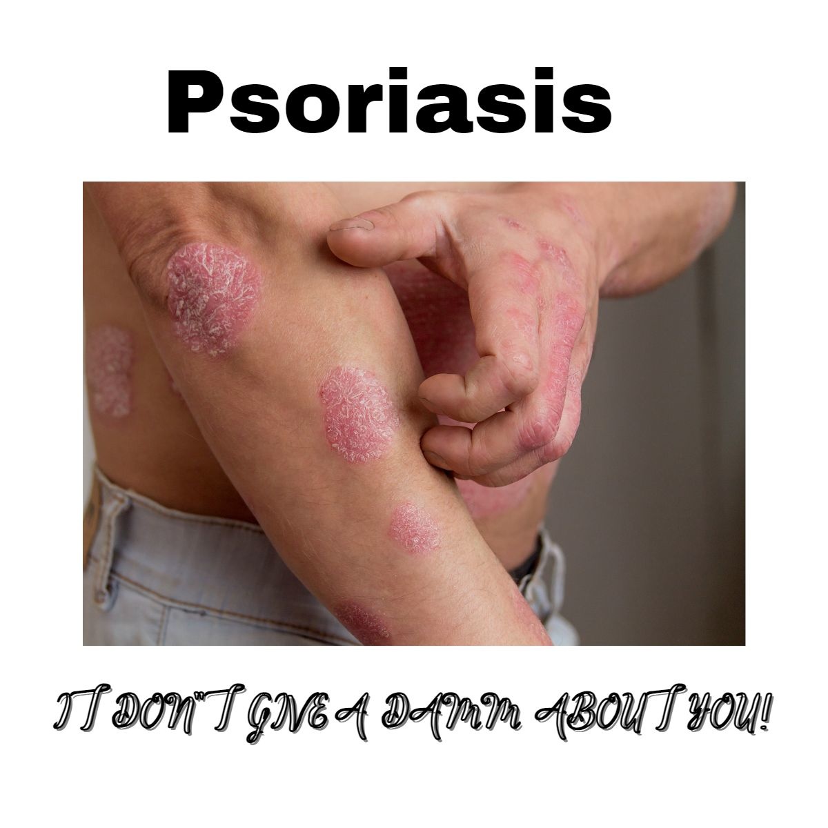 Best Skincare Practices for Psoriasis