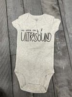 My New Favorite Thing As Seen on Ultrasound 6 months
