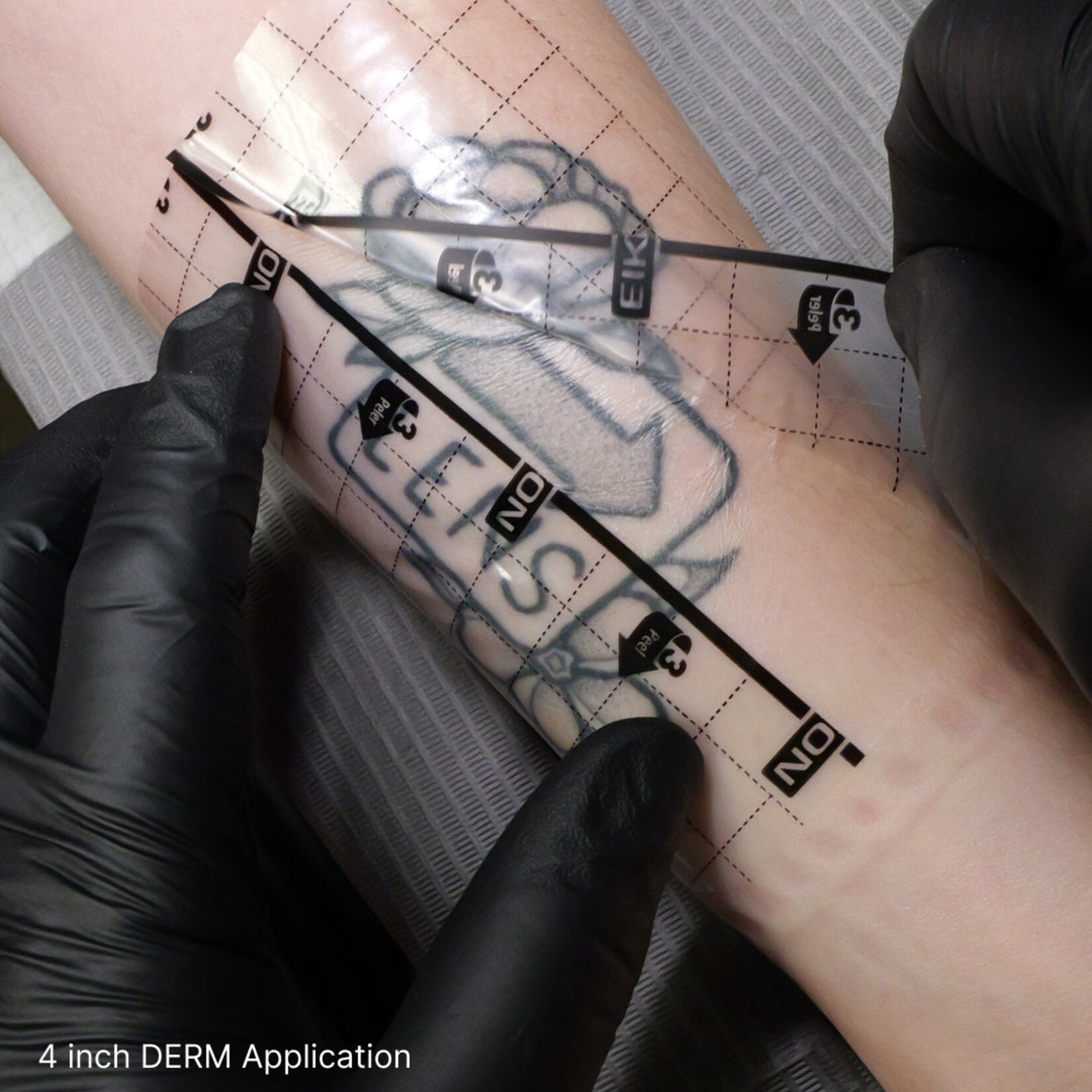 EIKON DERM TRANSPARENT BANDAGE