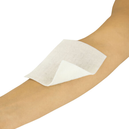 ViveCare Silver Alginate Dressing (Sterile)