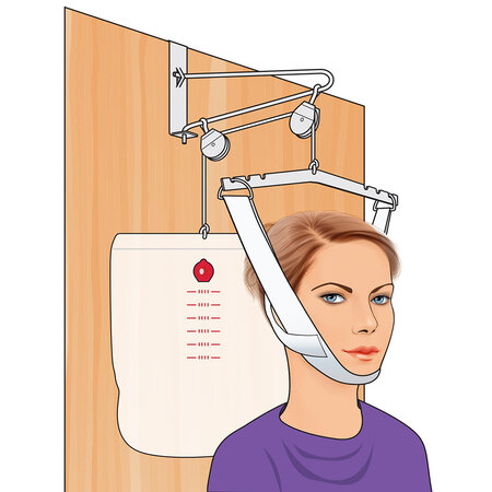 Nova Ortho-Med, INC. OVERDOOR TRACTION SET
