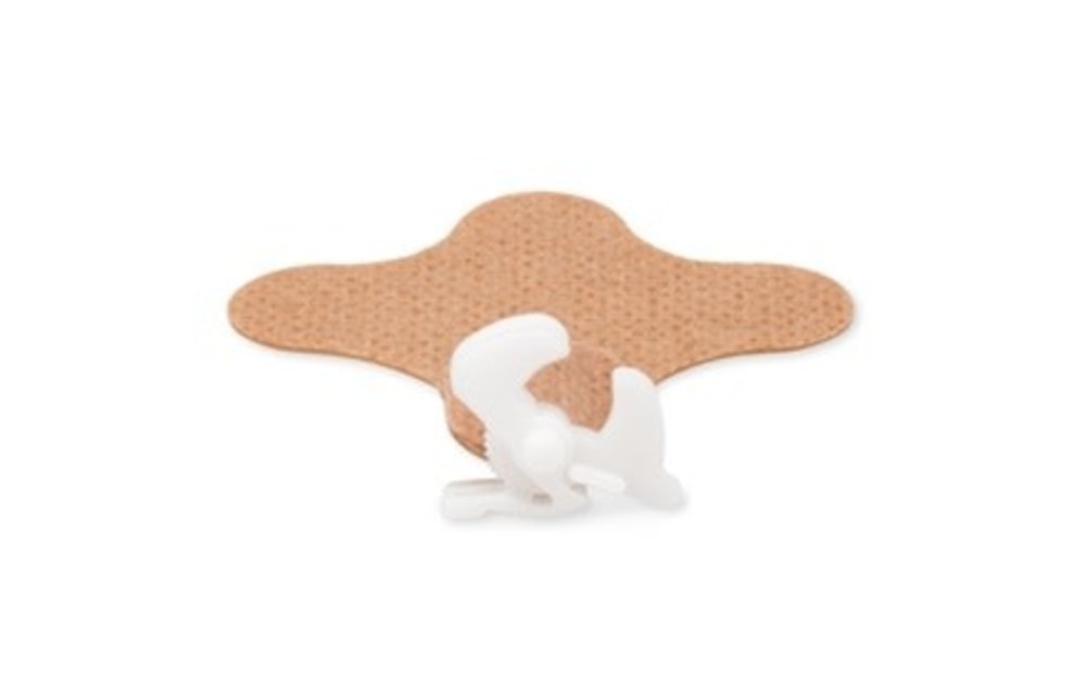 FEEDING TUBE ATTACH DEVICE STERILE BX/20