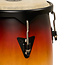 LP - LP646NYII-VSB - City II 10"-11" Set Mango Vintage Sunburst Black w/Double Stand