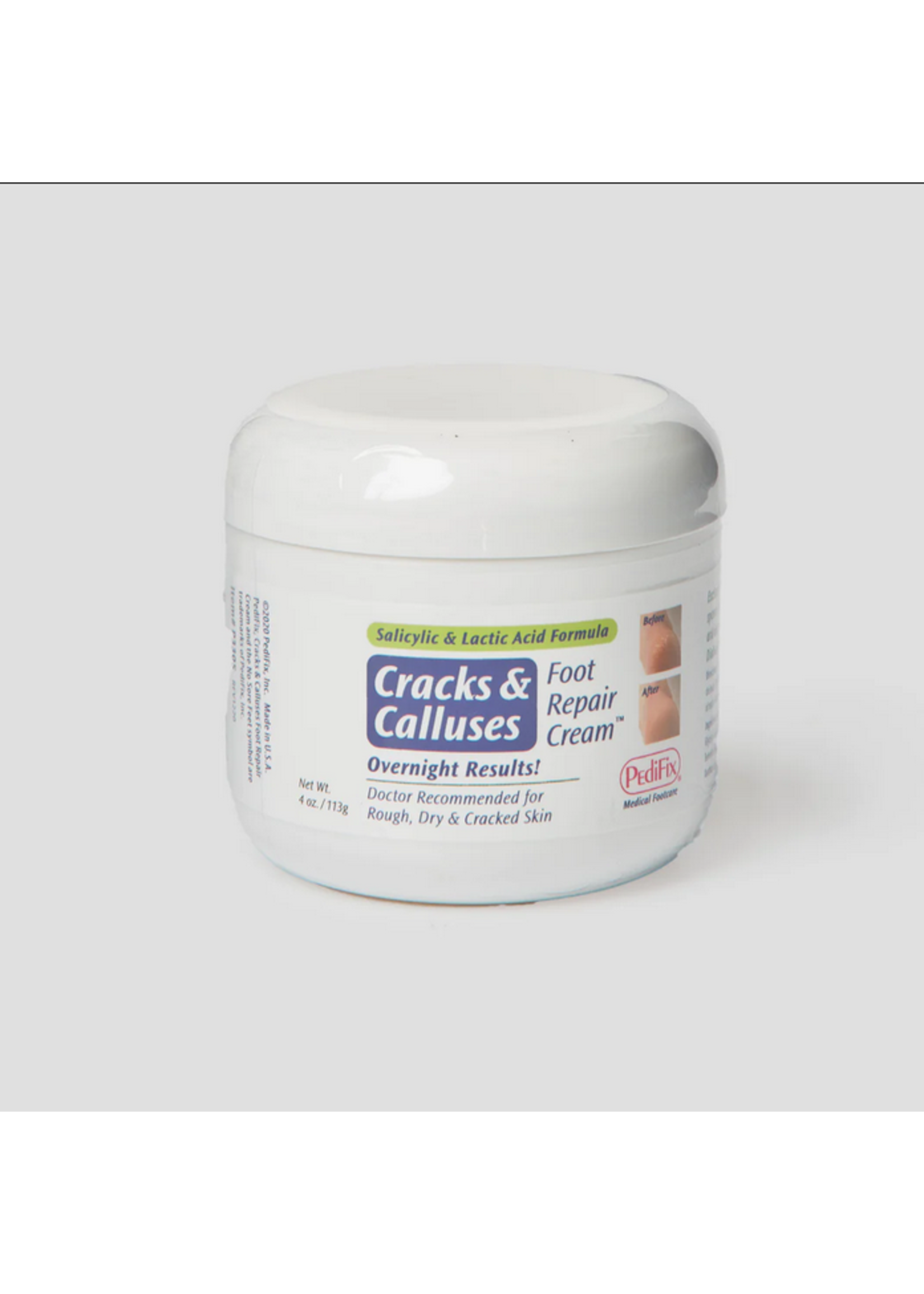 Pedifix P3305 Cracks Calluses  Foot Repair Cream