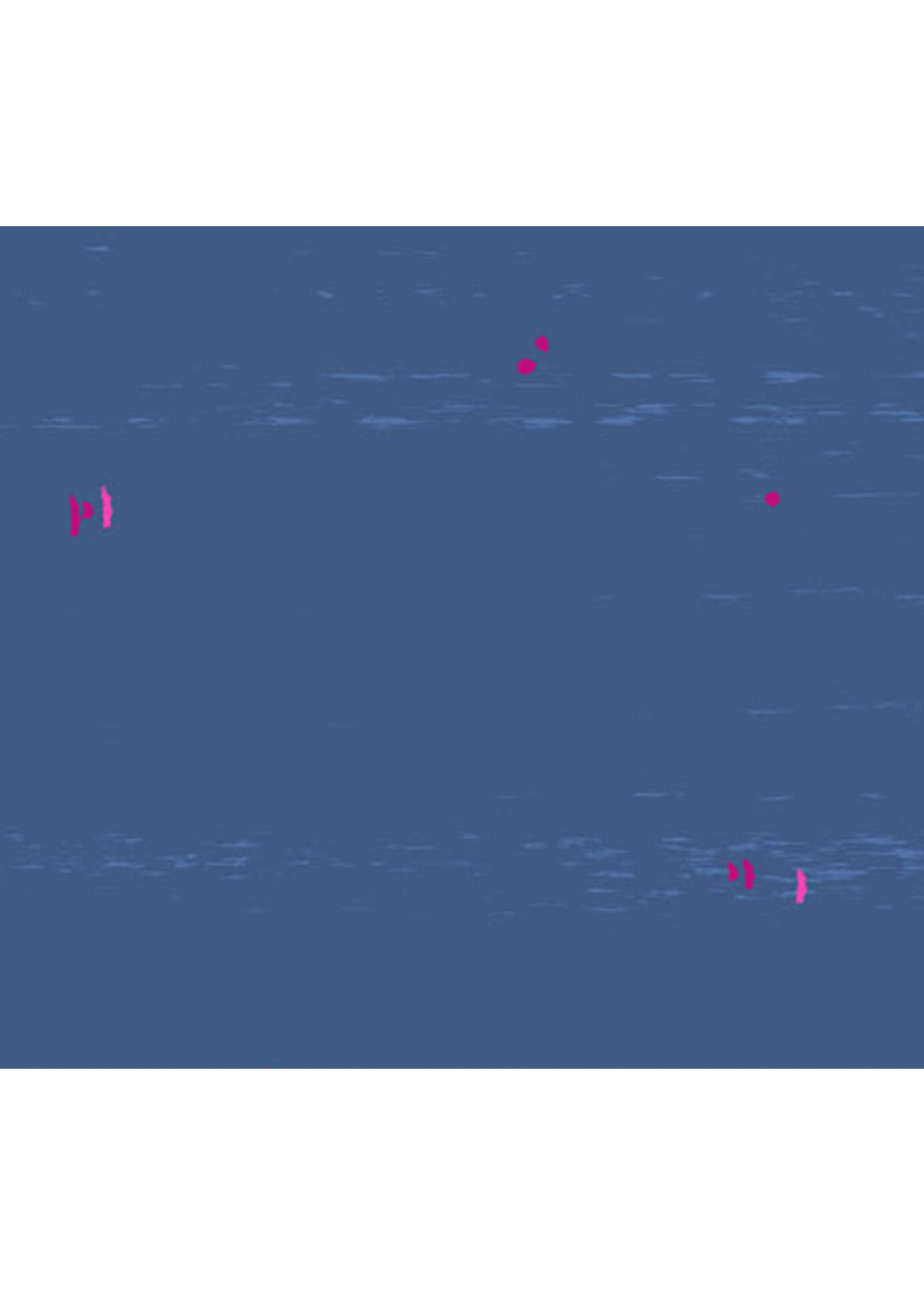 Andover Fabrics SUN PRINTS TEXTURES  CANVAS NAVY   1 Unit=10 cm = 4 inches