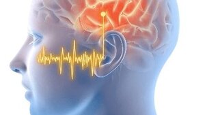 Tinnitus Tinnitus