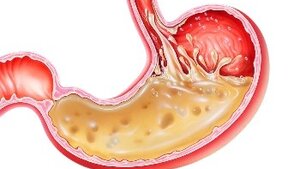 Digestion 101-Physio and Pathophysiology-Part II Digestion 101-Physio and Pathophysiology-Part II