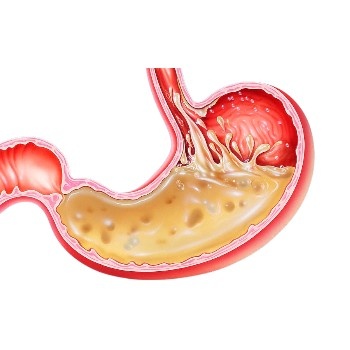 Digestion 101-Physio and Pathophysiology-Part II