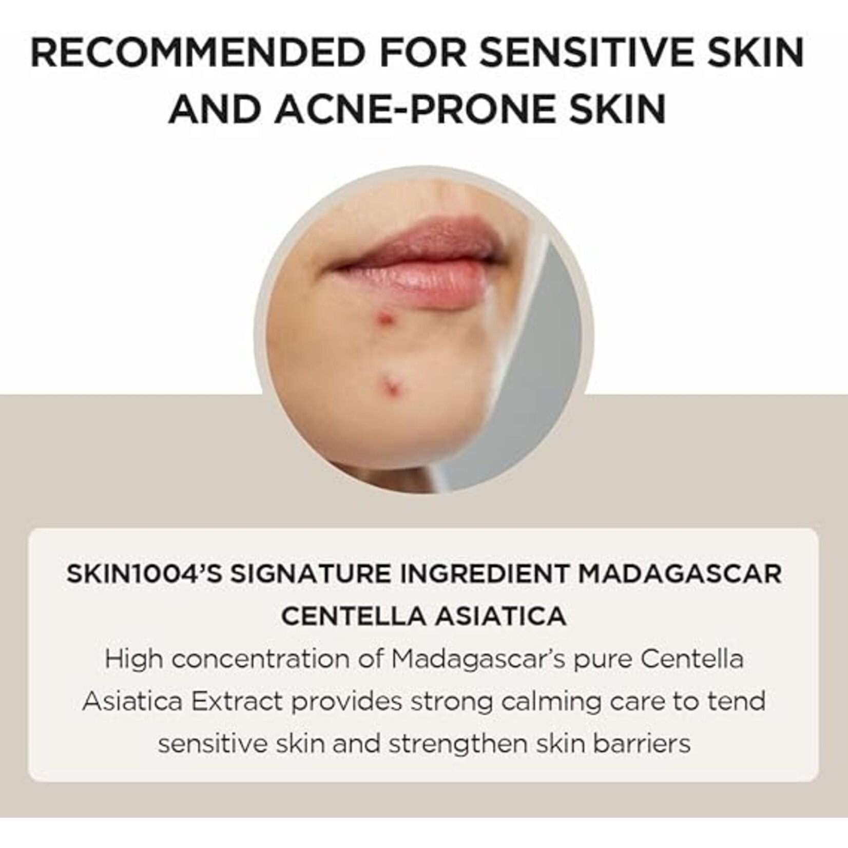 Skin1004 Ampoule Skin1004 Madagascar Centella 55 ml