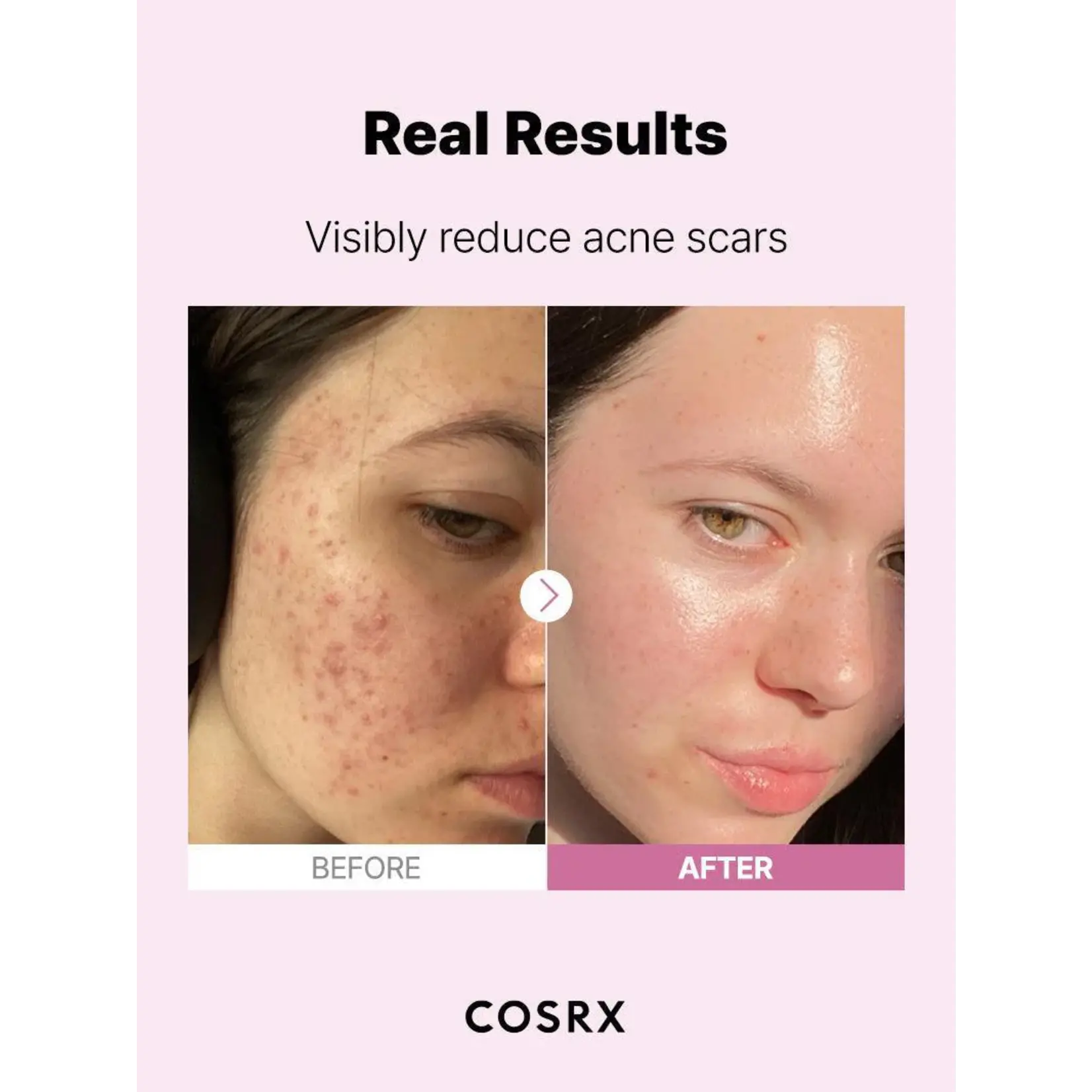 Cosrx Suero Cosrx Niacinamida 20 ml