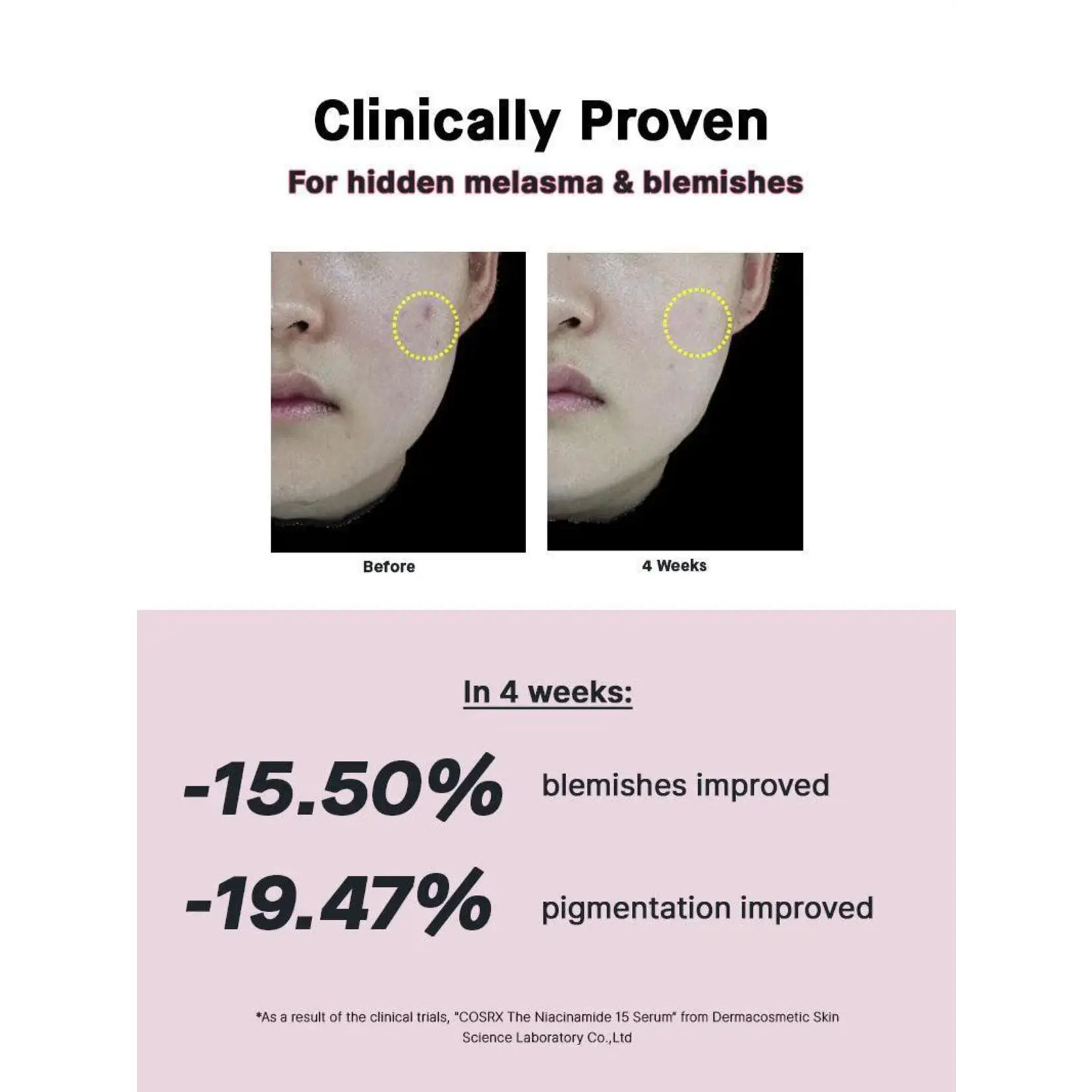 Cosrx Suero Cosrx Niacinamida 20 ml