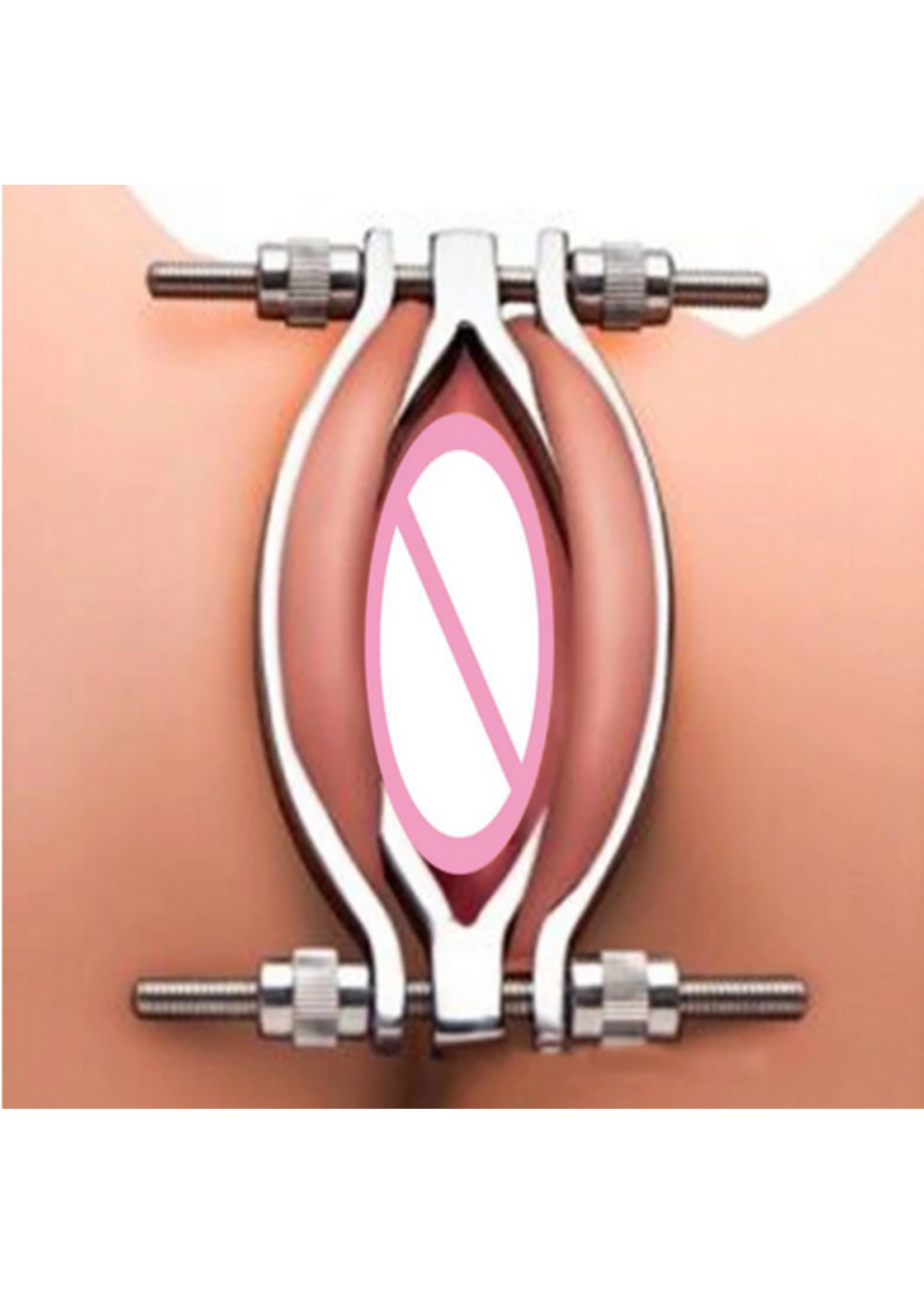 Value Labia Clamp