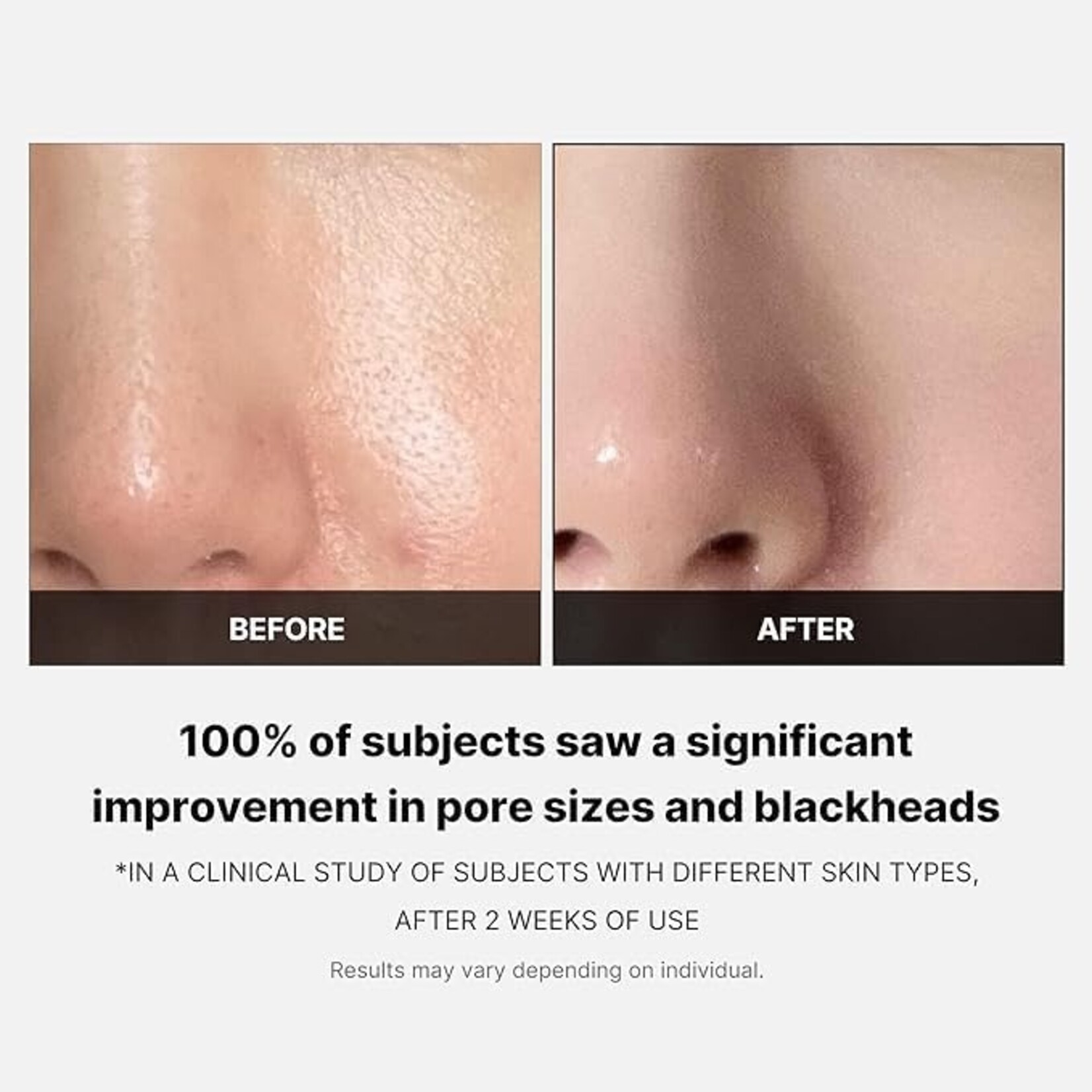 MEDICUBE Zero Pore Pad 2.0 70p