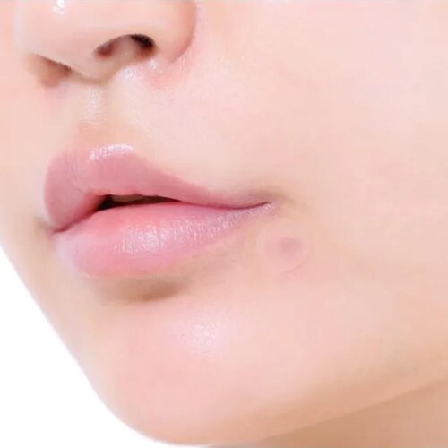 CarePlus Spot Cover Patch Calming 96p