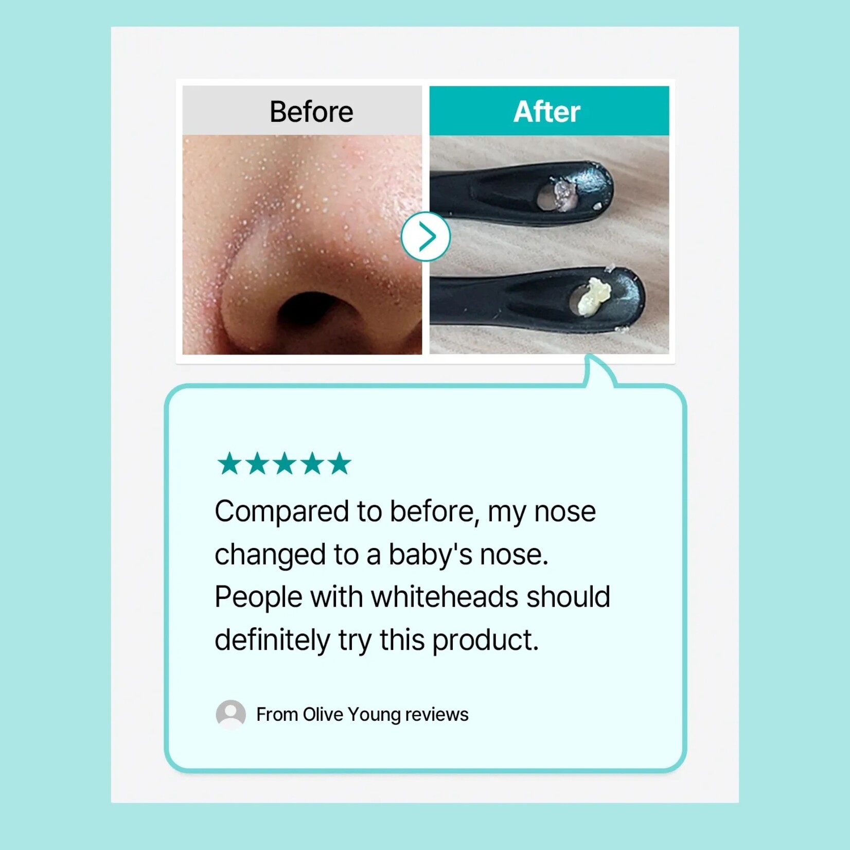 ILSO Natural Mild Clear Nose Pack 5p