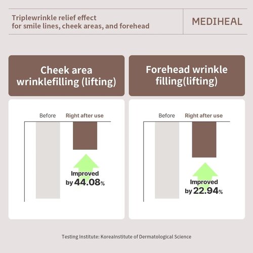 MEDIHEAL Retinol Collagen Cream Lifting Mask 1p MEDIHEAL Retinol Collagen Cream Lifting Mask 1p