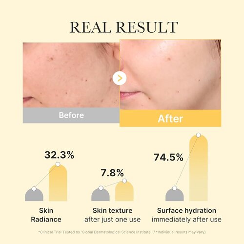 MEDICUBE Kojic Acid Turmeric Brightening Gel Mask 28g 1p