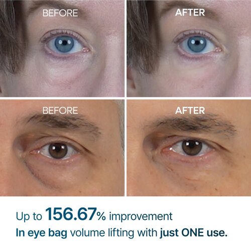 Dr.Melaxin Eyephalt Eye Cream for Eyebags 10mL Dr.Melaxin Eyephalt Eye Cream for Eyebags 10mL