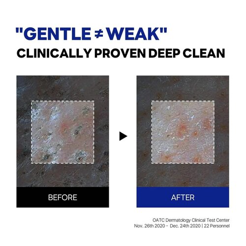 Round Lab Birch Juice Moisturizing Cleanser 150mL Round Lab Birch Juice Moisturizing Cleanser 150mL