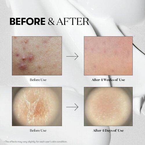 VT cosmetics Reedle Shot 700 Essence 30mL VT cosmetics Reedle Shot 700 Essence 30mL