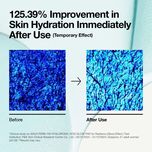 ANUA PDRN Hyaluronic Glow Pad 180mL / 60pads
