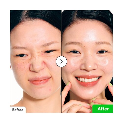 EQQUALBERRY Aloe PDRN Calming Serum 30mL