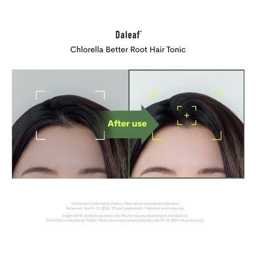 Daleaf Chlorella Better Root Hair Tonic 100mL
