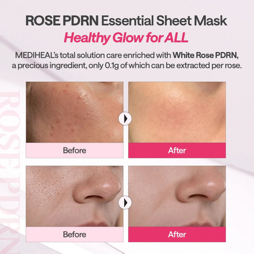 MEDIHEAL British White Rose PDRN Essential Mask 24g MEDIHEAL British White Rose PDRN Essential Mask 24g