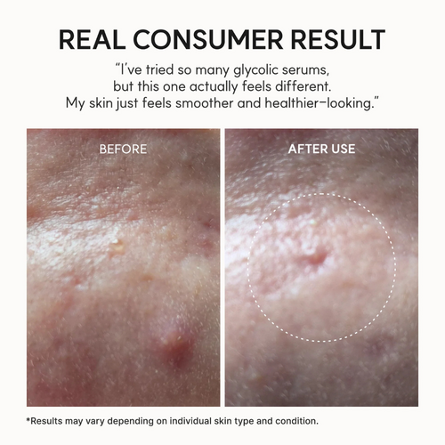 ARENCIA Eraser Shot Glycolic Acid Booster 30mL ARENCIA Eraser Shot Glycolic Acid Booster 30mL