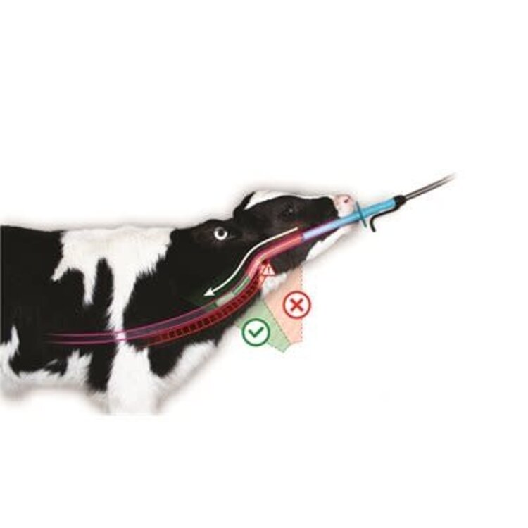 ANTAHI Trusti - Flexi Tuber Starter Pack (Complete w/ Bottle & Flexi Tuber Attachment)