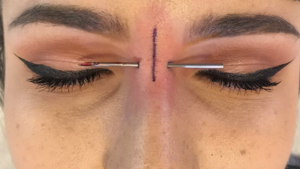 A Guide to the Practice of Safe Piercing
