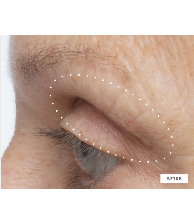 Farmhouse Fresh Firm-Tastic™ Eyes