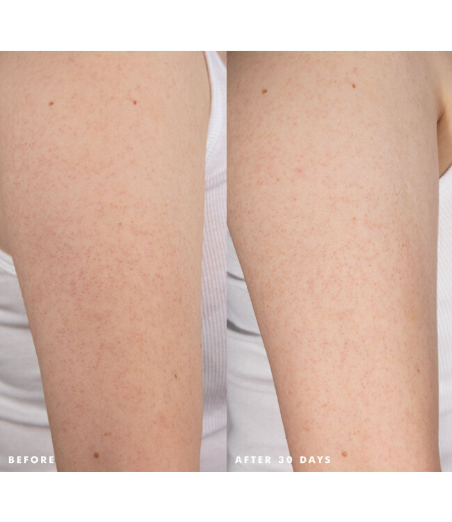 Farmhouse Fresh Smooth Reveal Resurfacing Silky Serum - 3.5oz