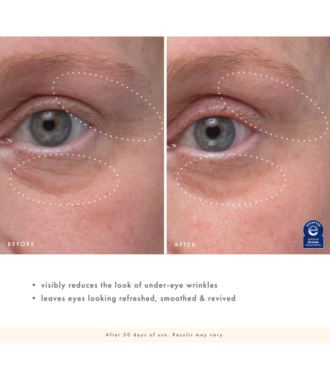 Farmhouse Fresh Eye'm Revived™ Total Renewal Cream - .5 oz