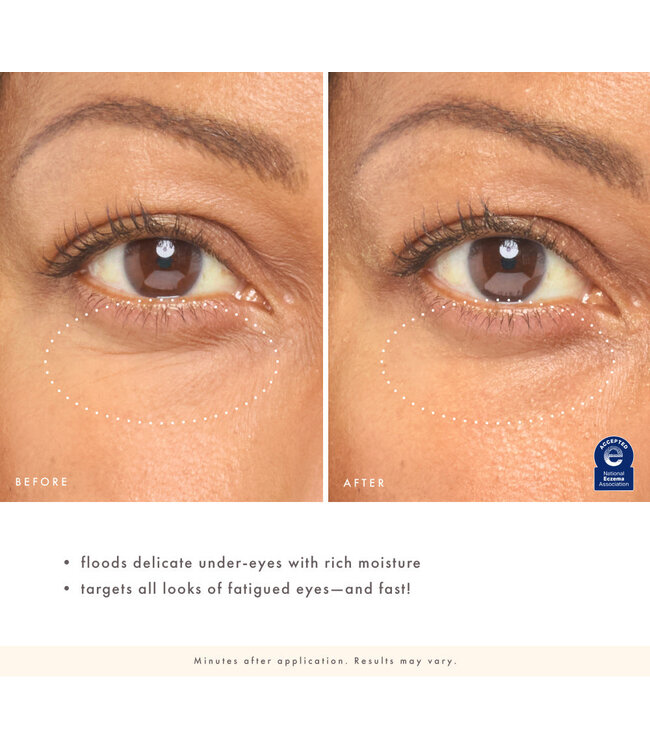 Farmhouse Fresh Eye'm Revived™ Total Renewal Cream - .5 oz