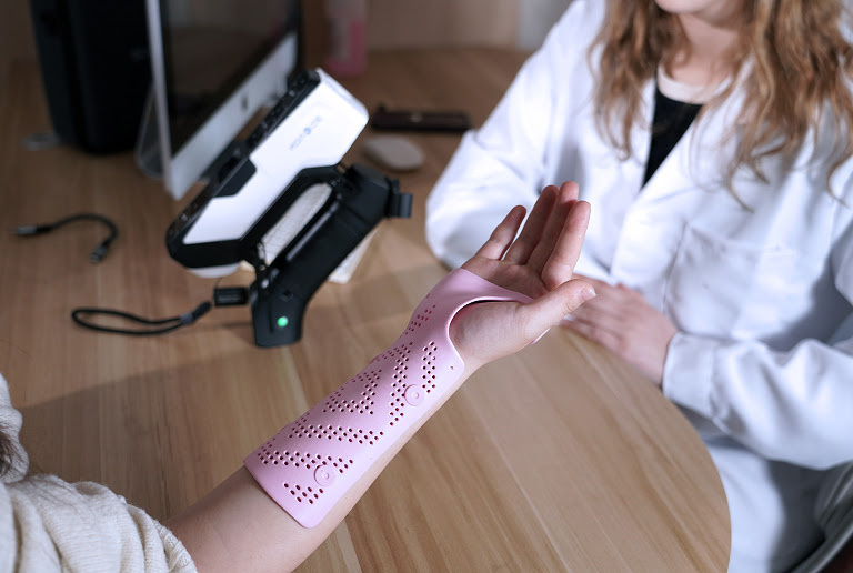 Healthcare professional holding a woman's arm with a 3D printed cast.